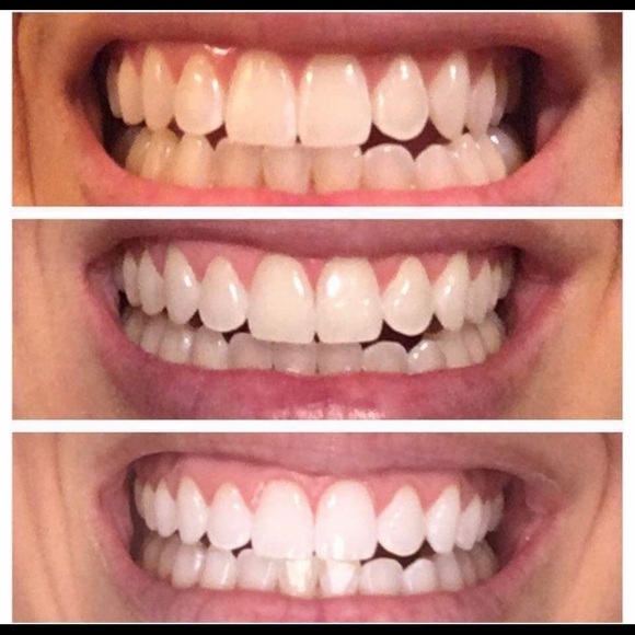 New-Three (3)Nuskin Ap24 Whitening Fluoride Toothpaste - Picture 11 of 17